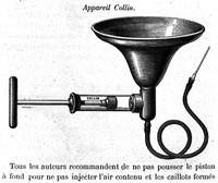 view M0005168: Collins blood transfusion apparatus, 1876