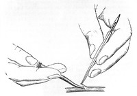 view M0005164: Transfusion forceps, 1864