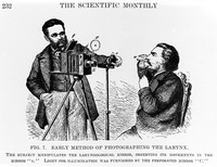 view M0004736: Early method of photographing the larynx