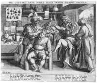 view M0005880: A man operating on the head of another, known as a "pierre de tete"