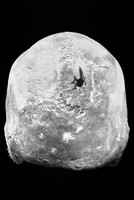 view M0006135: Posterior aspect of Cranium 2 from Huarochiri, showing trephinning