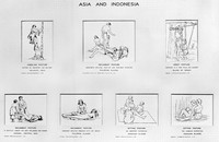 view M0006387: Wellcome Historical Medical Museum display: drawings of birth postures from Asia and Indonesia