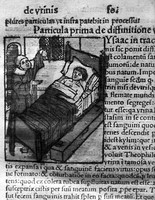 view M0007304: Illustration of patient in bed with physician examining urine flask