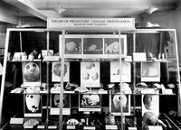 view M0006369: Upper section of a Wellcome Historical Medical Museum display case: "Theory of Prehistoric Cranial Trephination. Dr Wilson Parry Exhibition"