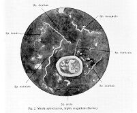 view M0009388: Mouth spirochaetes, highly magnified (Gerber)