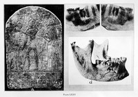 view M0008137: Ancient Egyptian pathology, from Moodie: <i>Paleopathology</i> (1923)