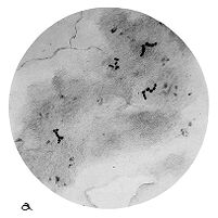 view M0009214EA: Micrococcus sp. Undt, from Moodie: <i>Paleopathology</i> / M0009214EB: Micrococcus: the oldest known bacteria, from Moodie: <i>Paleopathology</i>