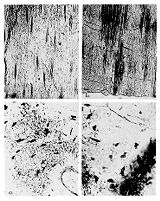 view M0009216: Disruption of Osseous lacunae of a Permian fish invading bacteria, from Moodie: <i>Paleopathology</i>