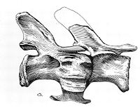 view M0008861: The oldest known example of osteomyelitis