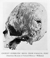 view M0009138: Syphilitic skull from Paracas, Peru