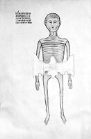 view M0007576B: Manuscript illustration of an anatomical figure from <i>Anothomia Philippi Septimi</i>, 1345