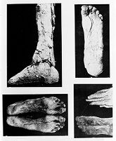 view M0008481: Photographs of an unwrapped mummy illustrating the processes of mummification