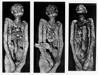 view M0008473: Photographs of an unwrapped mummy illustrating the processes of mummification