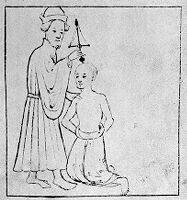 view M0010165: Surgeon trepanning a man, 13th century