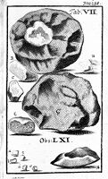 view M0010898: Stones extracted from the bladder