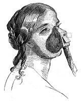 view M0009621: Ether inhalation apparatus in use