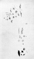 view M0010373: Pigment-matter from portal vein, 19th century