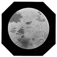 view M0010710: Yeast in a string-of-beads formation, evidence of illness "morts-flats" in the stomach pouch of a silk worm chrysalis
