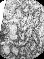 view M0010842: Microscopic image of elephant's hair, c.1840