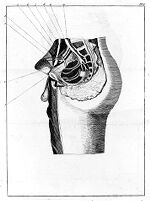 view M0010850: Gimbernat: <i>A new method of operating</i>, 1795: plate II