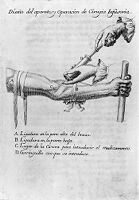 view M0011658: Syringe injecting medicine into an arm