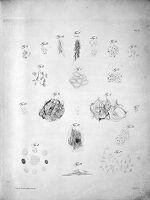view M0011428: Microscopal examination of various types of tumour