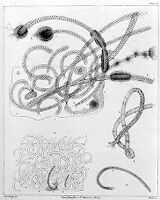 view M0011333: Enterobryus elegans: parasitic infestation of intestins