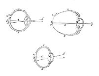 view M0011110: Diagrams of three eyes with different conditions: emmetropic, myopic and hypermetropic