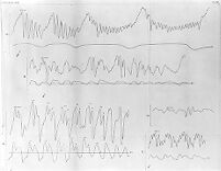 view M0011263: Tracings of Carl Friedrich W. Ludwig's kymograph