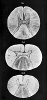 view M0011331: Appearance of transverse sections of the spinal column