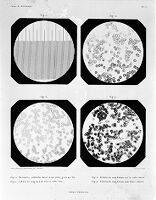 view M0011262: Earliest microphotographs of human blood cells