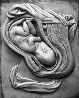 view M0012190EB: Photograph of a wax plaque showing the foetus in utero