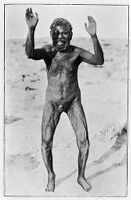 view M0012310: A "boned" man, Australia