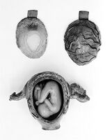 view M0012191EC: Photograph of a complete female anatomical wax model, view from above