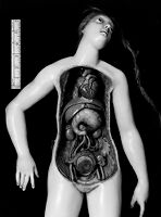 view M0012197: Photograph of a female anatomical wax model, close up of the torso from above with a layer removed to reveal the organs beneath the stomach and a foetus in utero