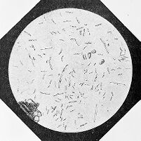 view M0013315: Magnification of Flachery