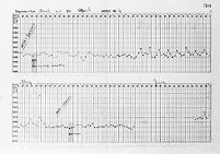 view M0013169: Chart recording antitoxin production from an innoculated horse
