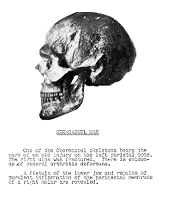 view M0013578: Skull of the Obercassel Man