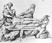 view M0013400: Illustration depicting treatment of a dislocated shoulder