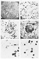 view M0013311: Magnifications of anthrax bacillus