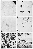 view M0013309: Magnifications of various bacilli