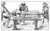 view M0013477: Illustration showing apparatus for correction of dislocation of the spine.
