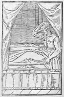 view M0013858: Man undergoing plastic surgery on the upper lip, 16th century