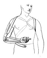 view M0013410: Illustration of an artificial arm designed by de Beaufort