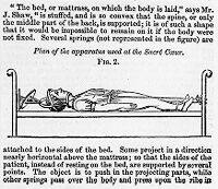 view M0013478: Illustration showing apparatus for correction of dislocation of the spine.