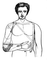 view M0013409: Illustration of an artificial arm designed by de Beaufort