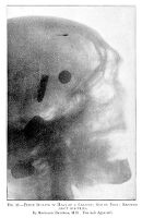 view M0013195: Radiograph showing bullets in a cadaver