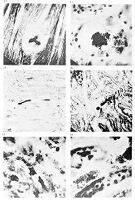view M0013308: Magnifications of various bacilli