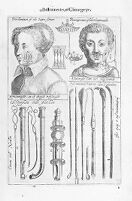 view M0012906: Illustration of operation on the cheek for harelip