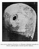 view M0014688: Trephined skull, Neolithic period